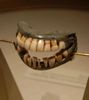 dentier.jpg
